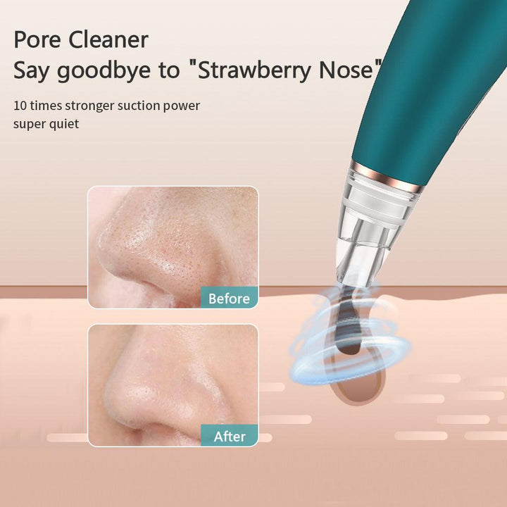 Rechargeable Vacuum Blackhead & Acne Pore Remover | Derma Suction Instrument - Khyber Imports